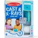 Melissa&Doug: Gipsovi i rendgenske snimke, rendgenski medicinski set za igru - Spin Master slika 1